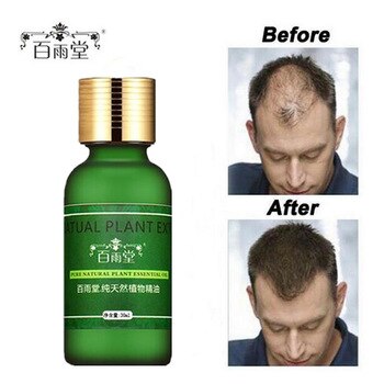 15pcs Hair Growth Essential Oils Essence Original 100% Hair Loss Liquid Health Care Beauty Dense Hair Care Hair Growth Serum